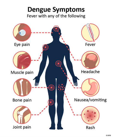 Chart of Common symptoms of dengue