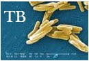 Images of a tuberculosis cell