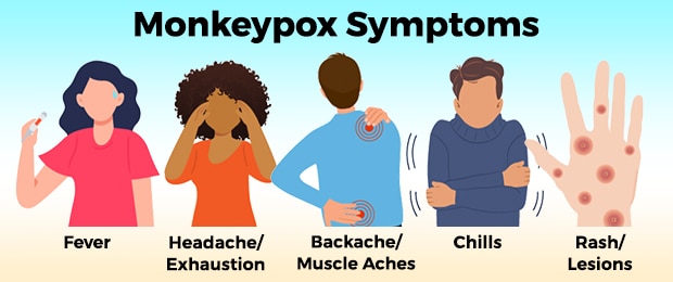 Illustration of 5 monkeypox symptoms. fever, headache/exhaustion, backache/muscle ache, chills, rash/lesions